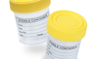 URINE CONTAINER