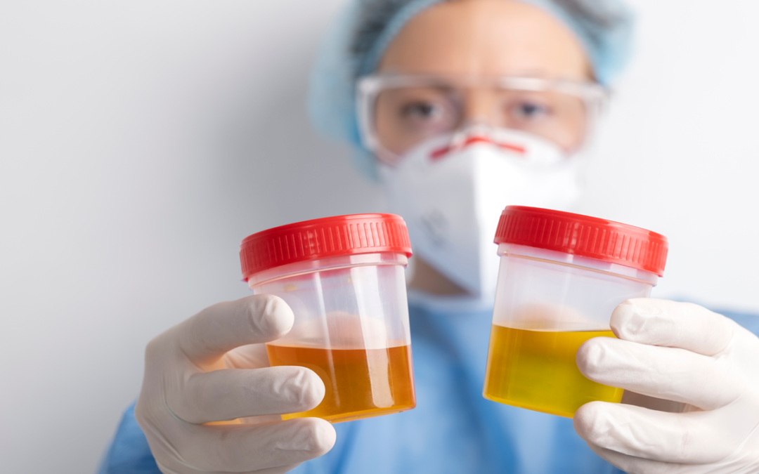 lab-doctor-performing-medical-exam-urine
