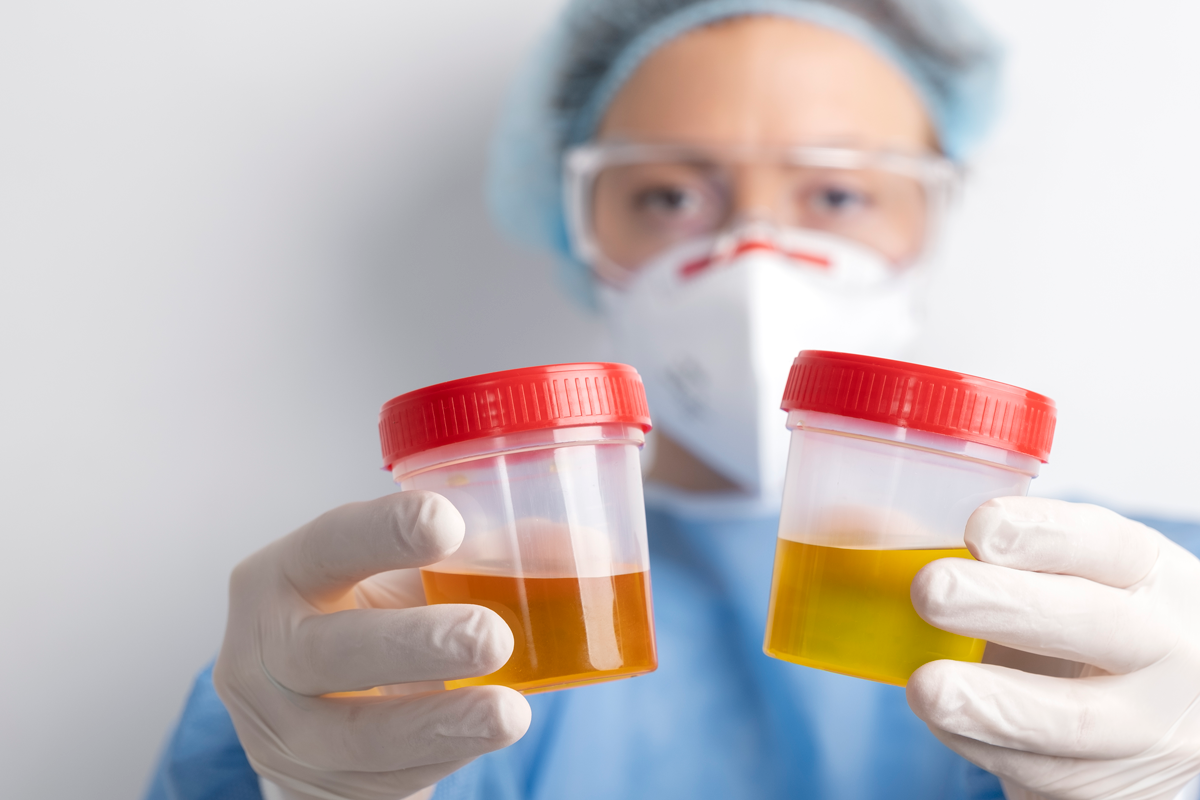 lab-doctor-performing-medical-exam-urine
